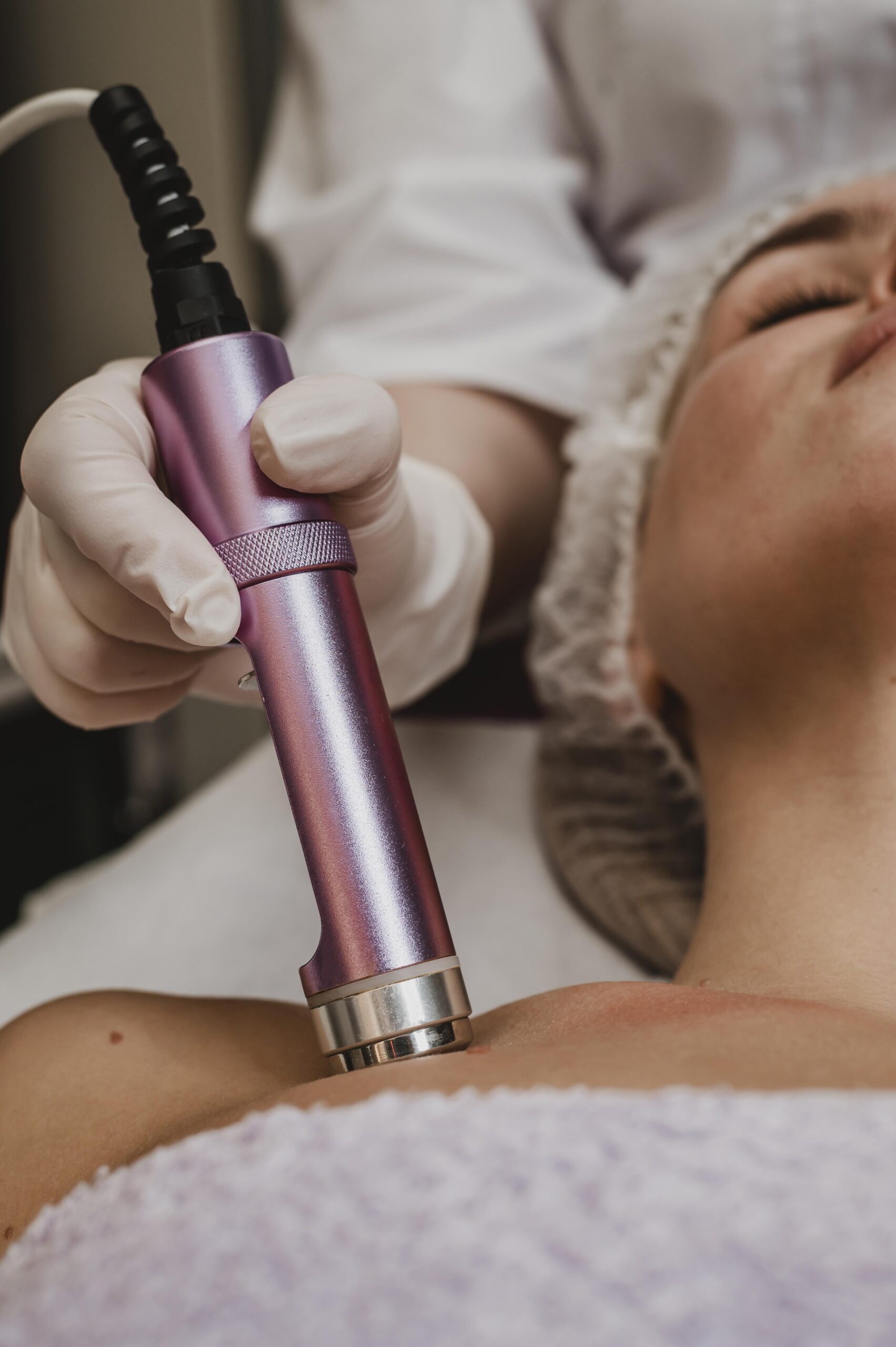 Laser peel carbon
