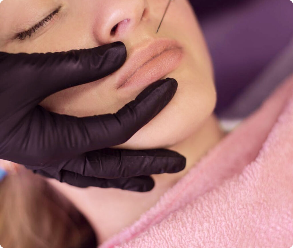 aumento de labios