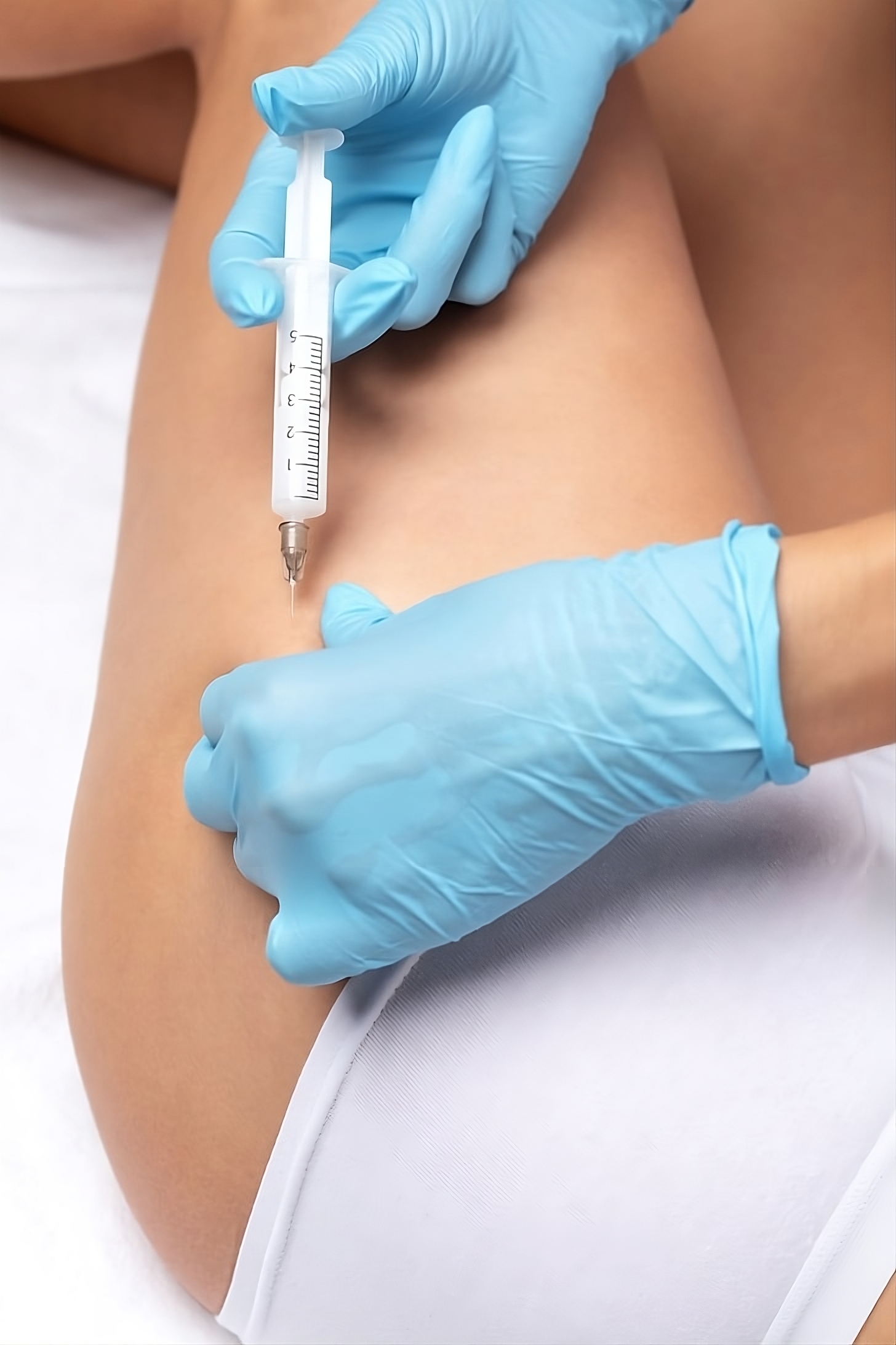 Mesoterapia